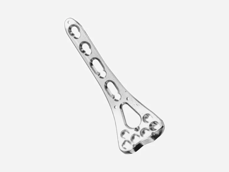 Distal radius locking plate